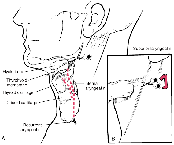 Superior Laryngeal Nerve Block 7363